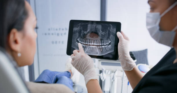 Licensed Dental Implants service in Harrison, OH - Smile Center Dentistry